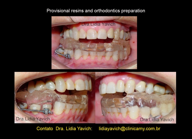 10 dentes prov e inicio da ortodontia